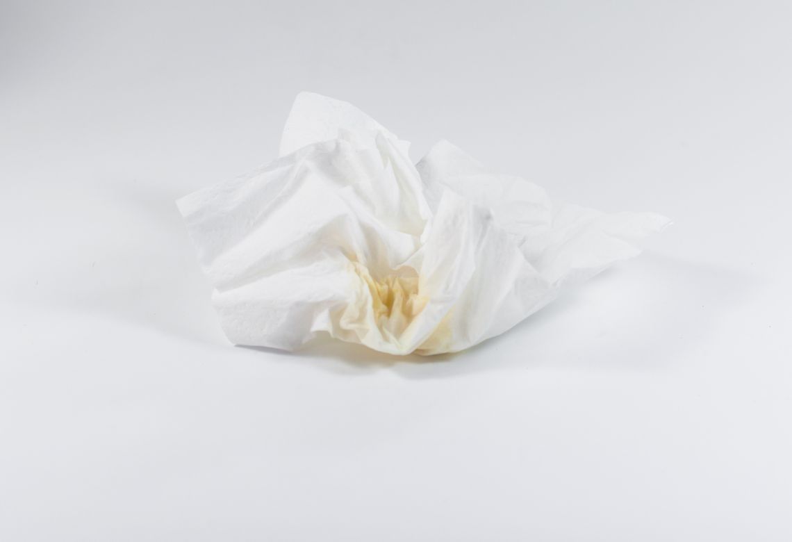 Catarro Amarelo Escuro: Quando se Preocupar, Causas Comuns e Soluções Eficazes